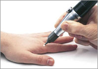 skin lesion removal in chicago